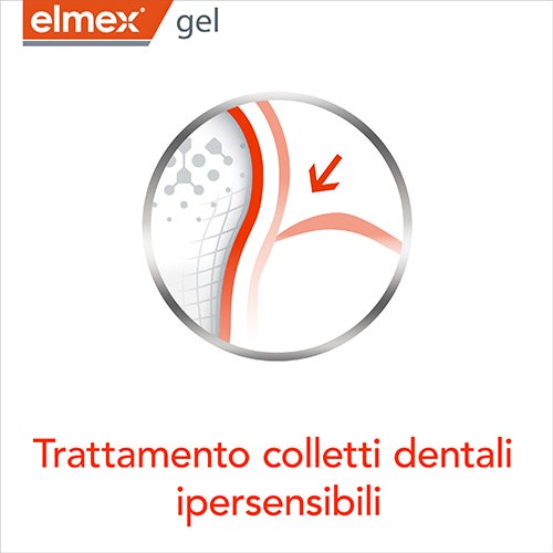 Trattamento colletti dentali ipersensibili