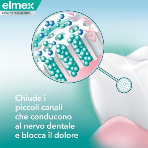 Chiude i piccoli canali che conducono al nervo dentale